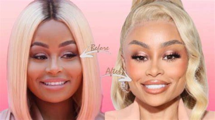 Blac Chyna Before Bleaching Her Skin