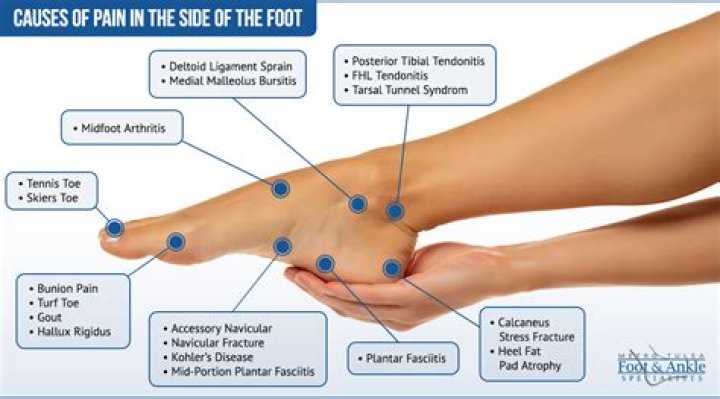 Can driving cause ankle pain?