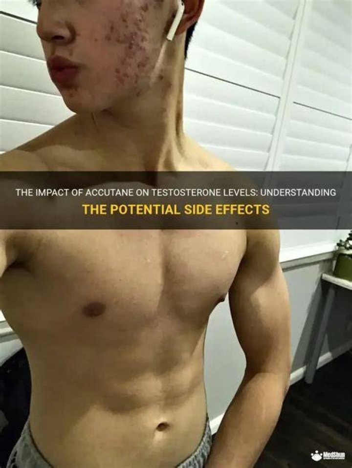 Does Accutane permanently lower testosterone?