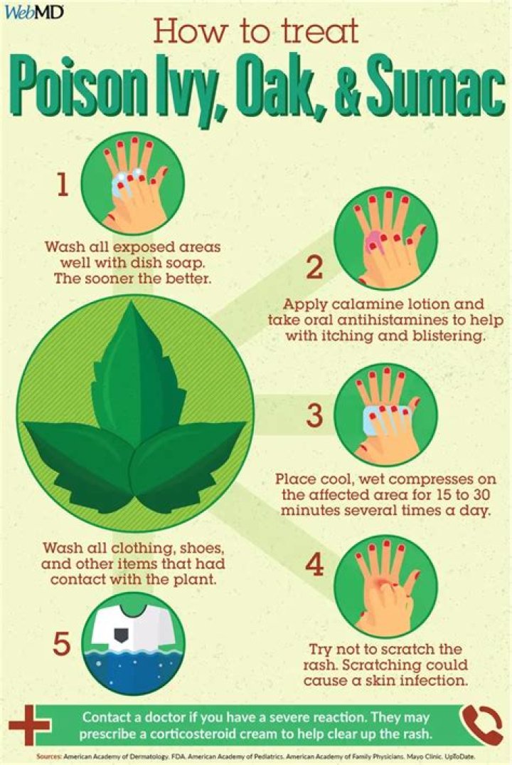 Does toothpaste treat poison ivy?