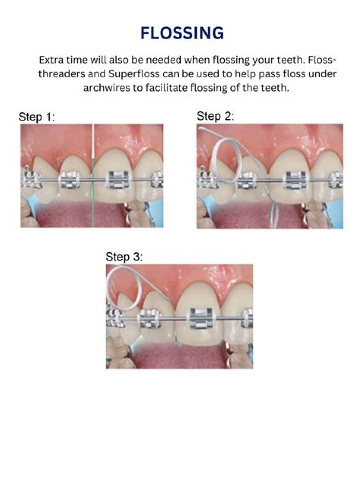 How do you floss with a threader?