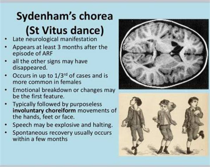 Is Sydenham’s chorea hereditary?
