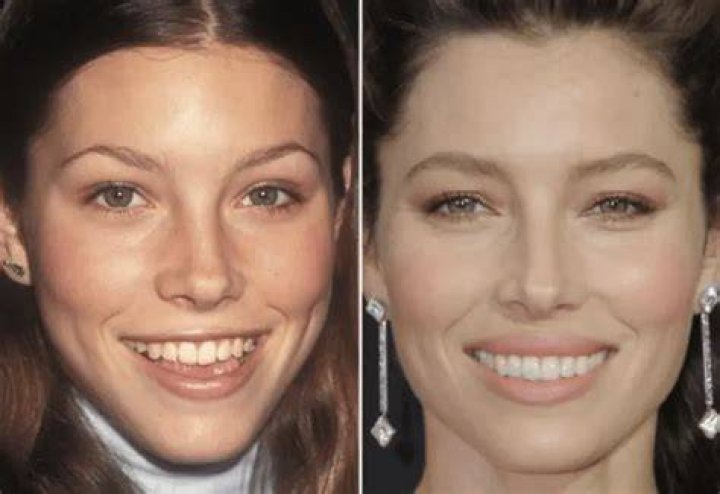 Jessica Biel Teeth braces