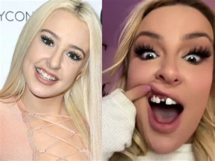 tana mongeau before_after